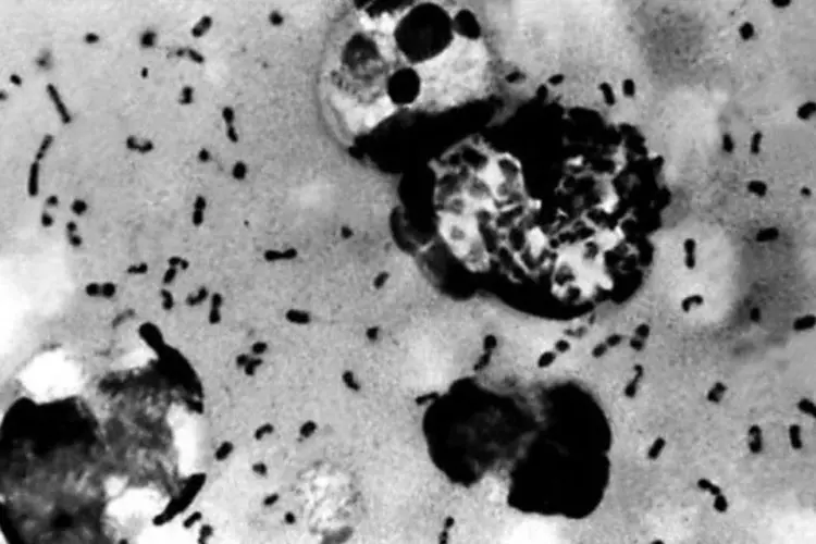 Historicamente, esta doença, também conhecida como "Peste negra", se disseminou pela Europa na segunda metade do século XIV, matando dezenas de milhões de pessoas (©AFP/Arquivo)