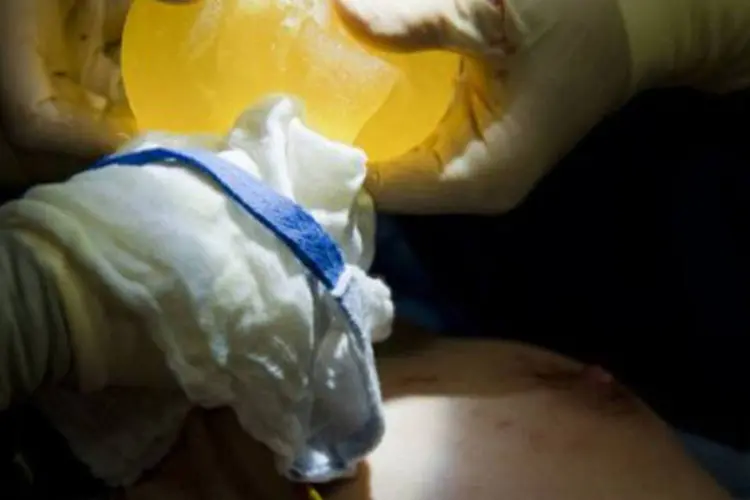 Cirurgião retira implante mamário rompido da companhia PIP, em operação feita em Caracas, Venezuela, em janeiro de 2012 (©AFP/Arquivo / Leo Ramirez)
