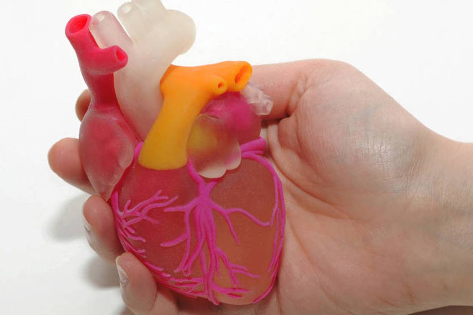 impressão de órgão em 3D (Reprodução/Thinkstock)
