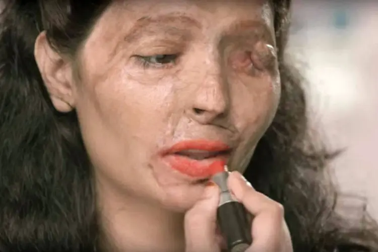 Comercial da ONG Make Love Not Scars: vídeo sobre maquiagem revela mensagem poderosa contra ataques com ácidos (Reprodução)