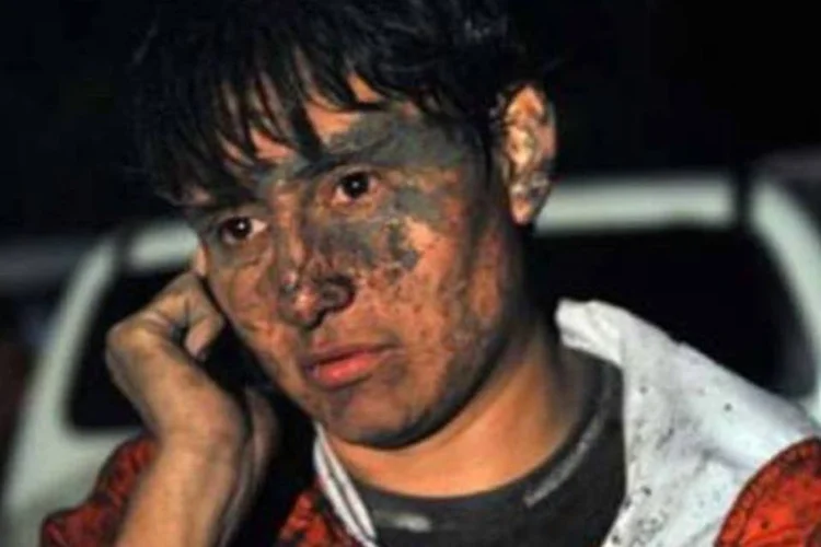 O cinegrafista Byron Secaid estava cobrindo a erupção quando foi atingido por uma chuva de pedras (.)