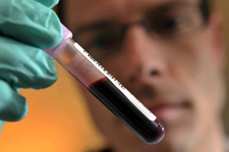 
	Laborat&oacute;rio: Os Centros de Controle e Preven&ccedil;&atilde;o de Doen&ccedil;as (CDC) tinham contabilizado at&eacute; o momento 51 casos de pessoas com zika nos EUA
 (Fabrice Coffrini/AFP)