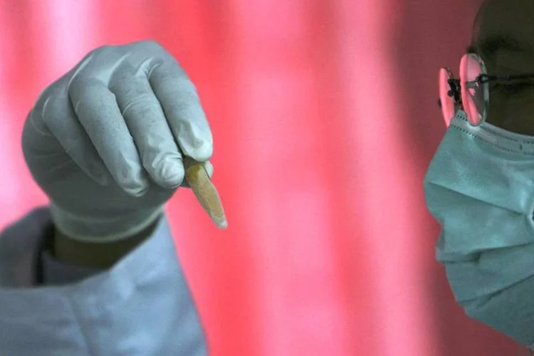 Tratamento contra câncer: além da revisão dos procedimentos, o ministério criou uma gratificação para incentivar hospitais a fazer mais cirurgias (Dimas Ardian / Getty Images)