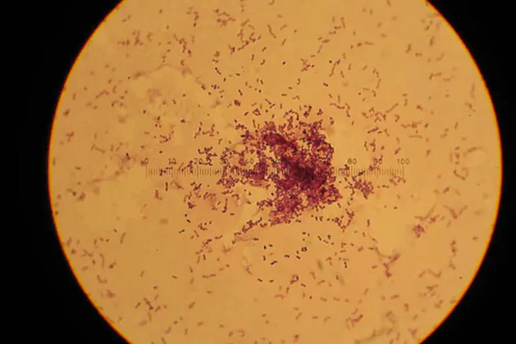 Lactococcus lactis ao microscópio: além de fermentar leite, bactéria pode produzir biocombustível (Reprodução)