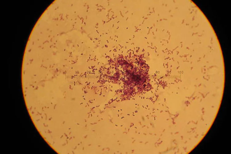 Lactococcus lactis ao microscópio: além de fermentar leite, bactéria pode produzir biocombustível (Reprodução)