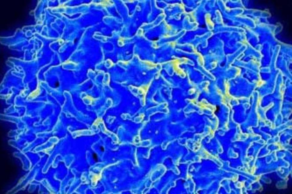 Congelar células pode mudar resultado em estudos sobre lúpus