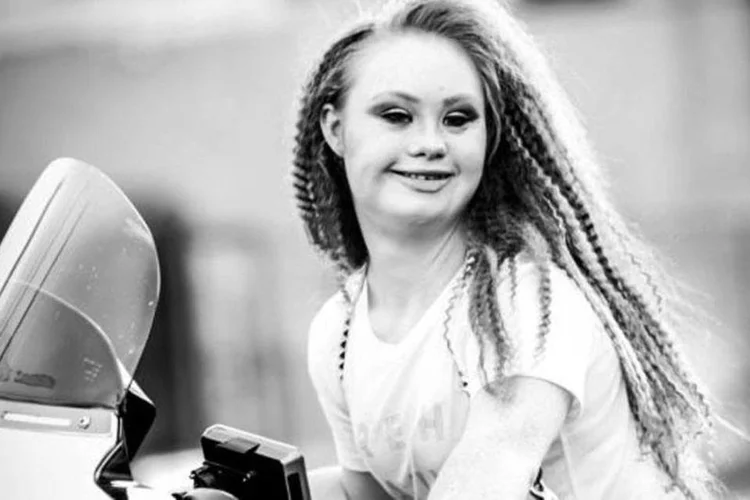 
	Madeline Stuart: com mais de 460 mil f&atilde;s no Facebook e 75 mil no Instagram, Maddy se tornou inspira&ccedil;&atilde;o para muitas pessoas com necessidades especiais
 (Divulgação)