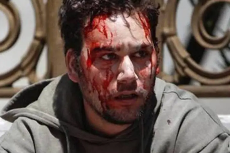 Manifestante com rosto coberto de sangue é visto durante conflitos com a polícia em Atenas, na Grécia (John Kolesidis/Reuters)
