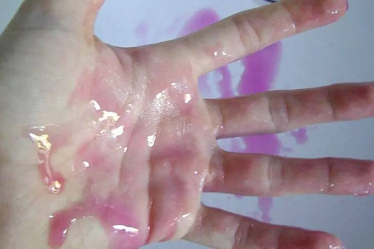 Mão cheia de sabonete líquido (Creative Commons/ Michela Mongardi)