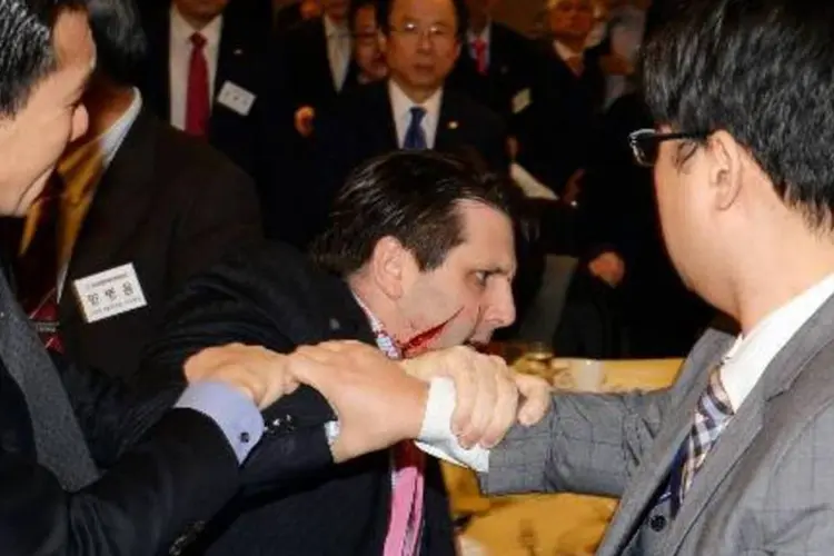 O embaixador dos Estados Unidos na Coreia do Sul, Mark Lippert, foi ferido a faca nesta quinta-feira em Seul por um militante nacionalista  (Munhwa Ilbo/AFP)