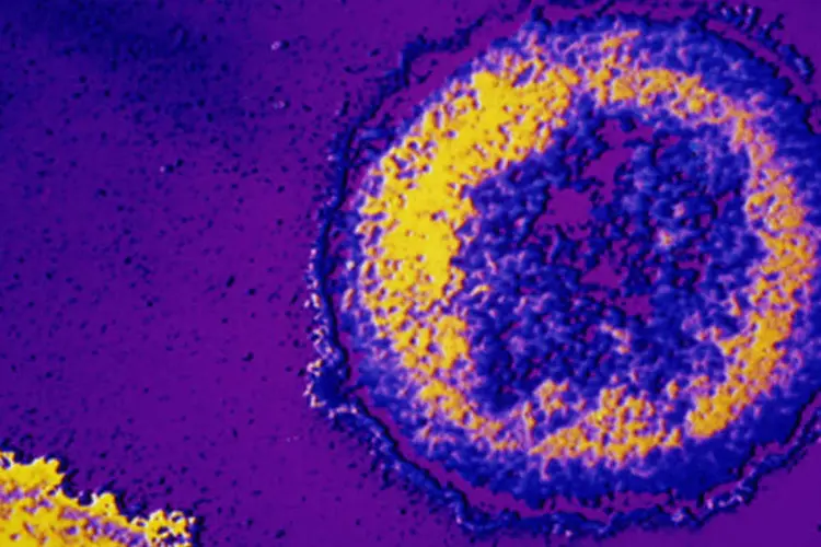 HIV - vírus da Aids (Getty Images/Getty Images)