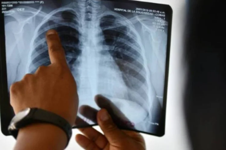 Médico examina uma radiografia: maioria dos progressos mais importantes ocorreram desde 2000 (Cris Bouroncle/AFP)
