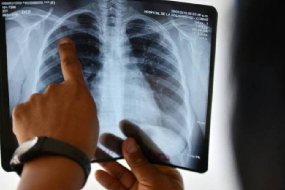 Progressos são insuficientes contra tuberculose, diz OMS