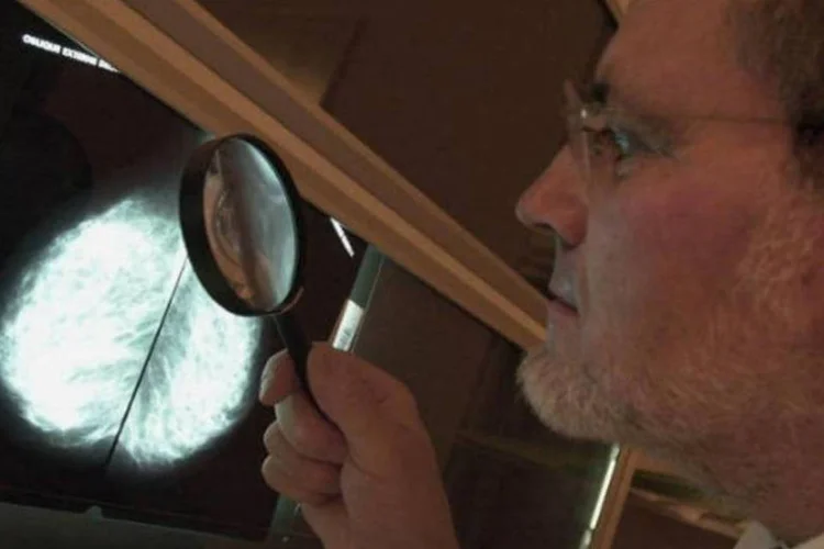 
	M&eacute;dico analisa radiografia de paciente com c&acirc;ncer
 (AFP / Mychele Daniau)