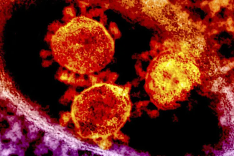 Partículas do coronavírus da MERS (National Institute for Allergy and Infectious Diseases/Handout via Reuters/Reuters)