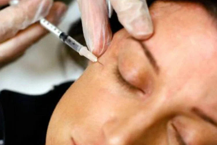 Botox: estudo revelou que ele pode bloquear sinais do nervo vago, que vai do cérebro ao abdômen (GETTY IMAGES NORTH AMERICA/AFP)