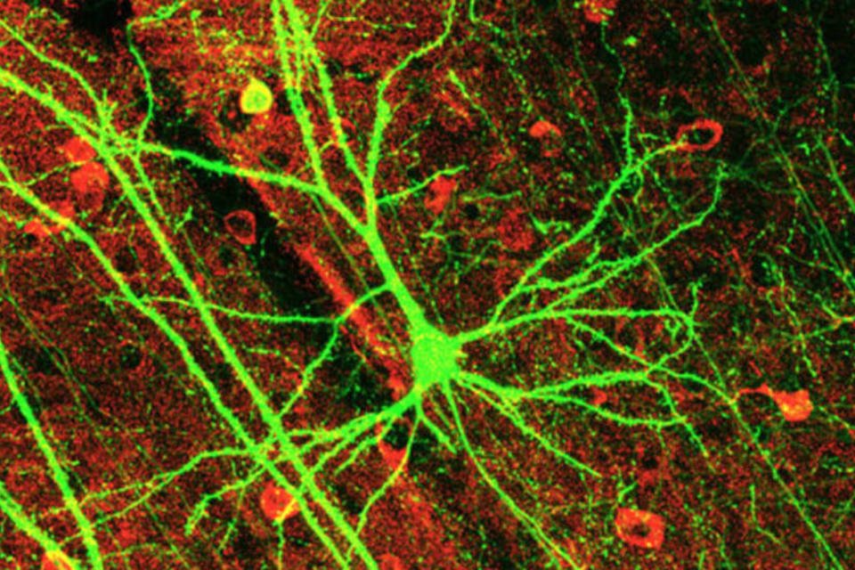 Molécula protege neurônios em condições de isquemia