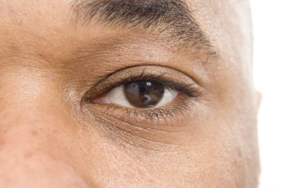 
	Olhos: atualmente, o Parkinson afeta uma de cada 500 pessoas
 (BananaStock/Thinkstock)