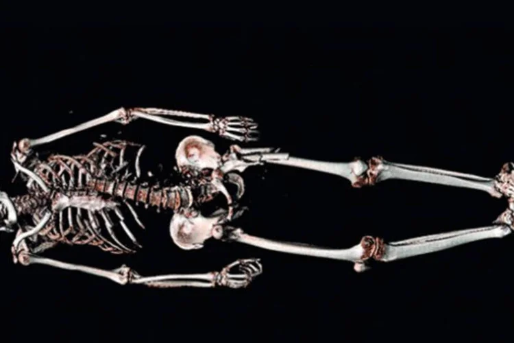 Investigação em 3D: A virtópsia identifica a causa da morte entre 60% e 80% dos casos se comparada com a autópsia, mas em 20 anos, deve alcançar 95% de acerto (Divulgação)