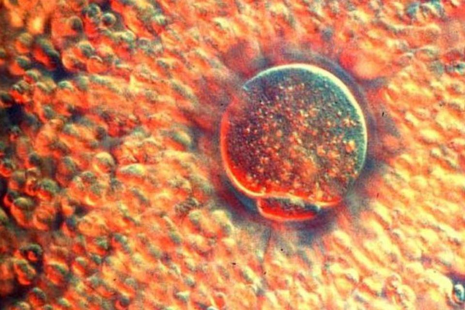 Estudo explica mecanismo que ajuda espermatozoide a encontrar óvulo