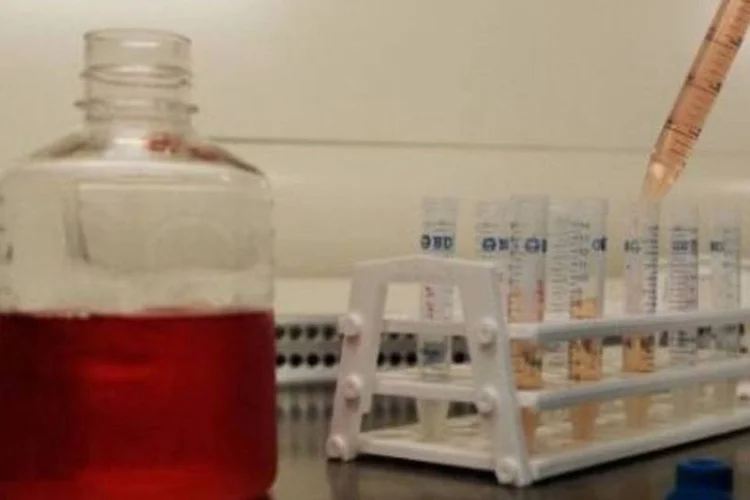 Pesquisas para descobrir vacinas contra Aids: Brasil tem custo elevado no tratamento da doença (.)