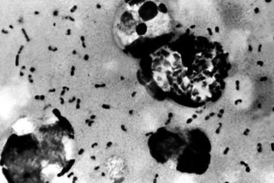 Estudo vincula peste negra da Idade Média a doença atual