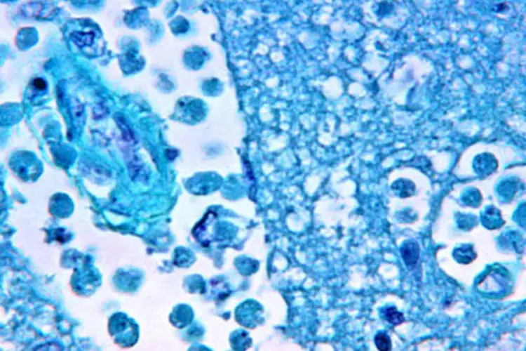 
	Fotomicrografia de tecido cerebral: ameba&nbsp;Naegleria fowleri, que vive principalmente em lagos, rios e tanques, foi descoberta h&aacute; meio s&eacute;culo
 (Getty Images)