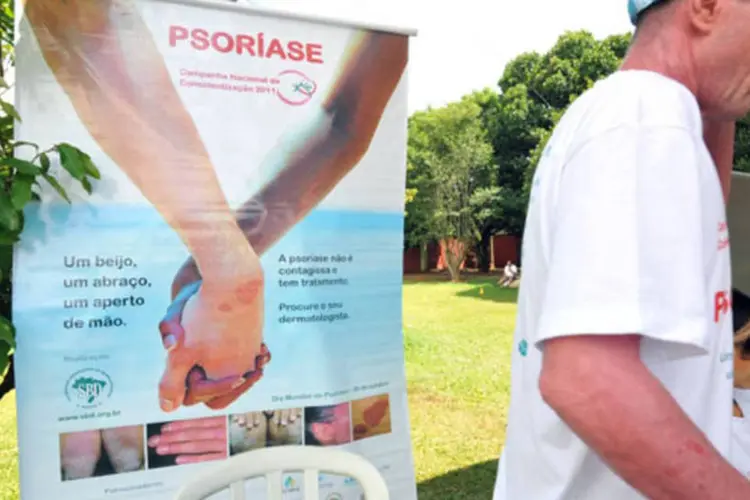 Campanha em parque sobre a psoríase: a doença não tem cura, mas seus sintomas podem ser controlados por meio de tratamento (Elza Fiuza/ABr)