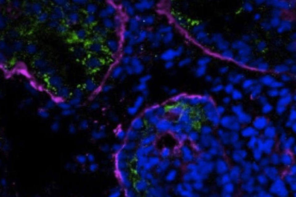 Cientistas criam tecidos renais a partir de células-tronco
