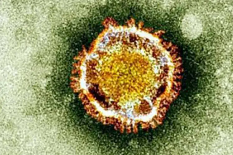 
	Imagem do coronavirus vista de um microsc&oacute;pio: os casos s&atilde;o os primeiros registrados na Tun&iacute;sia e indicam que o v&iacute;rus est&aacute; lentamente avan&ccedil;ando para al&eacute;m das fronteiras da Ar&aacute;bia Saudita
 (AFP)