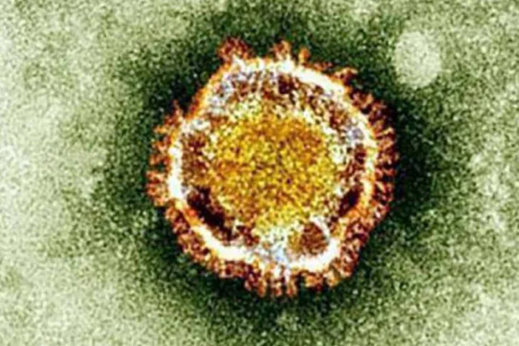 
	O coronav&iacute;rus, observado a partir de um microsc&oacute;pio:&nbsp;este v&iacute;rus, rebatizado como S&iacute;ndrome Respirat&oacute;ria Coronavirus do Oriente M&eacute;dio (MERS Cov, em ingl&ecirc;s), afetou principalmente pessoas que vivem na Ar&aacute;bia Saudita.
 (AFP)