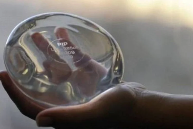 Um implante mamário da companhia francesa Poly Implant Prothese (Anne-Christine Poujoulat/AFP)