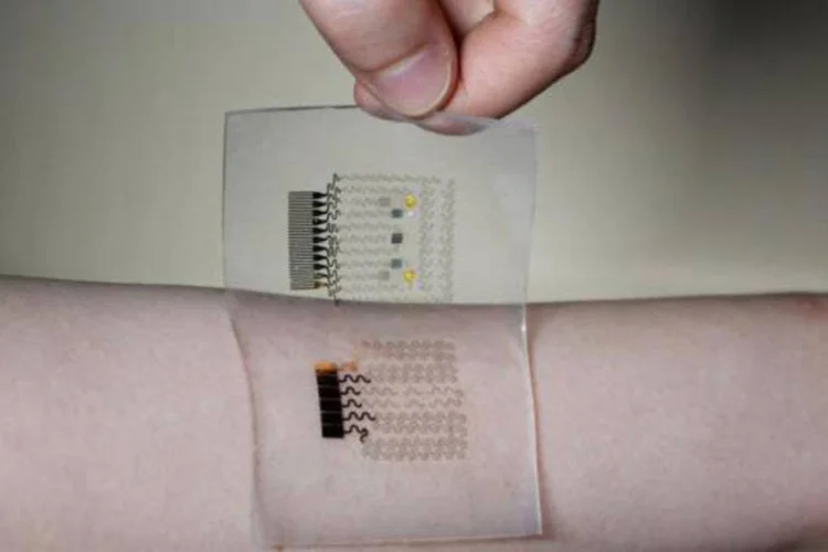 
	Pulseira contra diabetes: as agulhas s&atilde;o t&atilde;o fininhas que as picadas s&atilde;o quase impercept&iacute;veis
 (Hui Won Yun/ Divulgação/ Seoul National University)