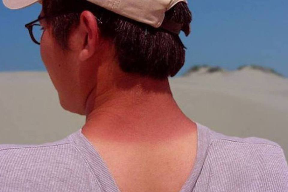 Especialistas alertam para a síndrome do melanoma familiar