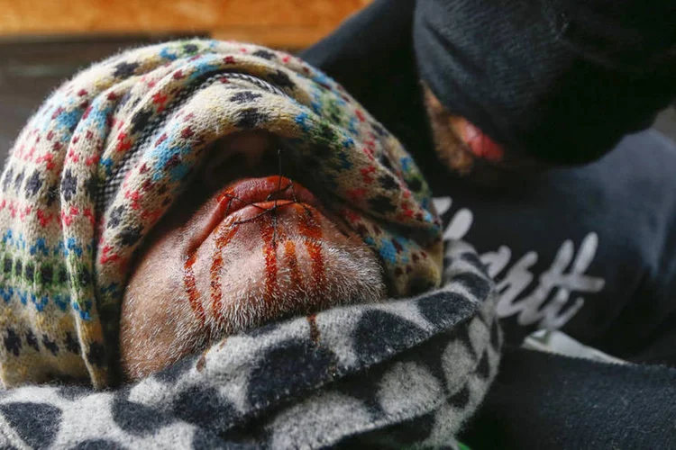 
	Calais: o gesto de costurar a pr&oacute;pria boca j&aacute; tinha sido usado por migrantes em novembro na Gr&eacute;cia
 (Yves Herman / Reuters)