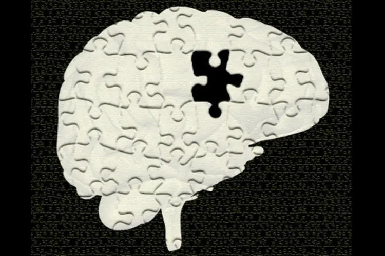 Cérebro: pesquisadores querem agora criar novas associações cerebrais inconscientes que ajudem pacientes a lidar melhor com a depressão (Getty Images)