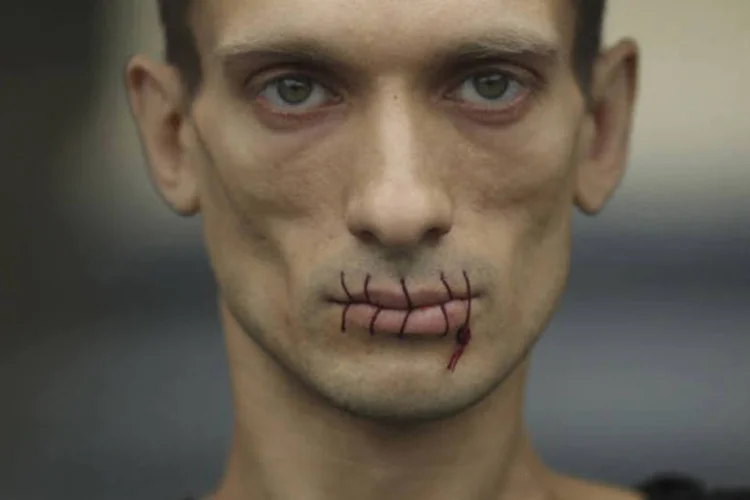 Pyotr Pavlensky: artista costurou a boca para protestar na Rússia (Reuters)