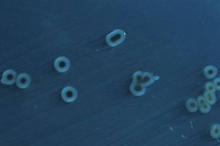 Salmonella enterica: também nas bactérias as macroglobulinas poderiam fazer parte de um sistema de defesa rudimentar (Wikimedia Commons)