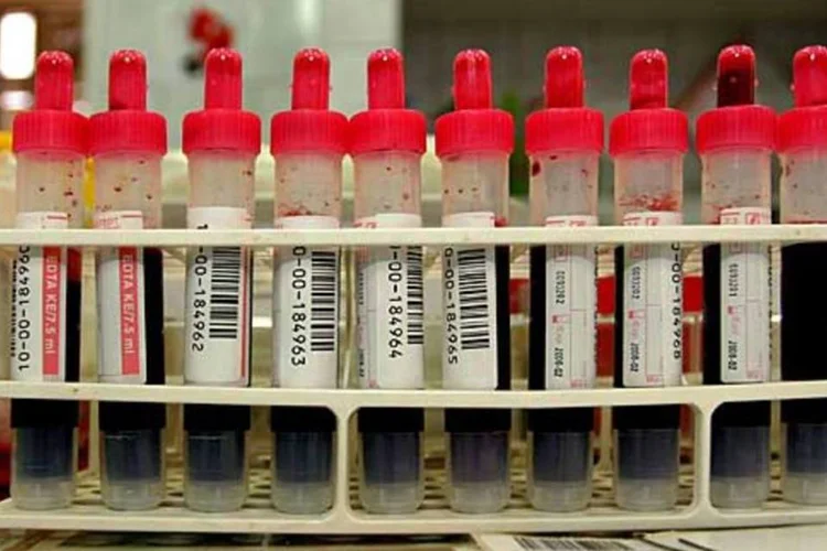 Entre os motivos da suspensão está a melhoria nas análises clínicas de sangue, que verificam uma possível presença do vírus HIV (Griszka Niewiadomski / SXC)