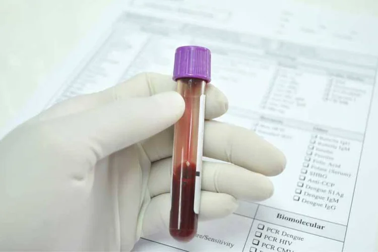 1. Seu tipo sanguíneo. (Thinkstock)