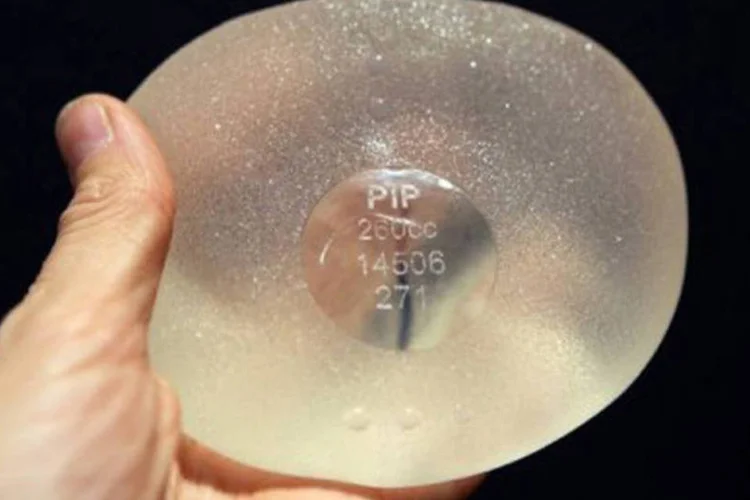 Cerca de 10.000 próteses da PIP foram retirados do mercado do Brasil, enquanto 25.000 mulheres brasileiras ainda utilizam estes implantes, de acordo com a Anvisa (Sebastien Nogier/AFP)