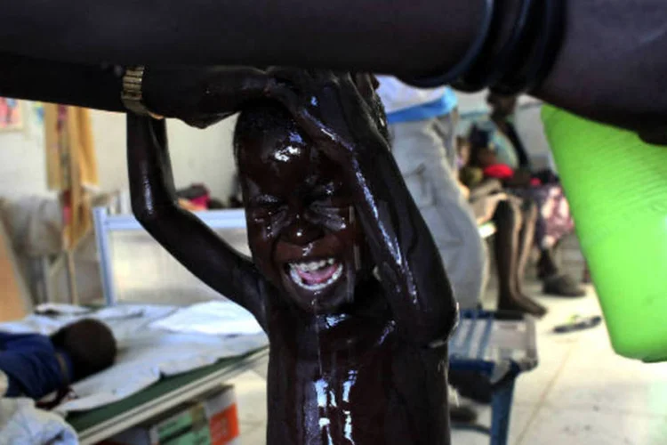 Uma criança do Sudão do Sul, mal-nutrida, recebe banho em uma enfermaria dos Médicos Sem Fronteiras. (28/5/2014)
 (REUTERS/Andreea Campeanu)