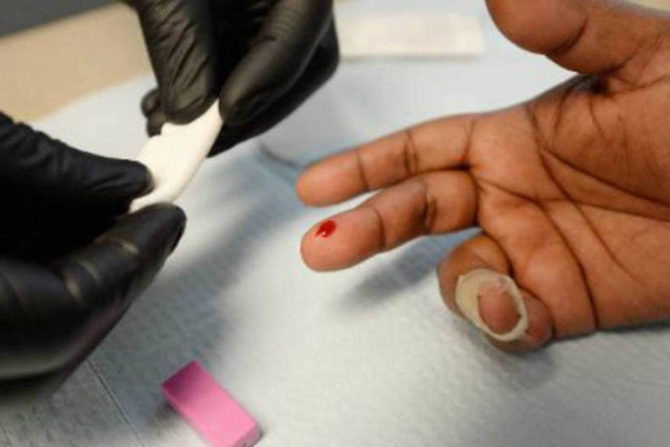 HIV pode ajudar a prevenir esclerose múltipla, revela estudo