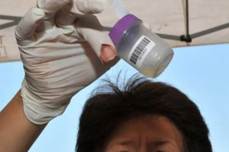 
	Teste de tubercuolose:&nbsp;de acordo com a secretaria, desde setembro de 2012, a doen&ccedil;a se desenvolveu em 14 crian&ccedil;as.
 (Alexander Joe/AFP)