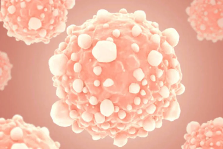 Tumor em ação: frequência a centros de mastologia caiu 75% no Sistema Único de Saúde entre março e maio deste ano, período de maior isolamento social por causa da pandemia (Getty Images/Getty Images)