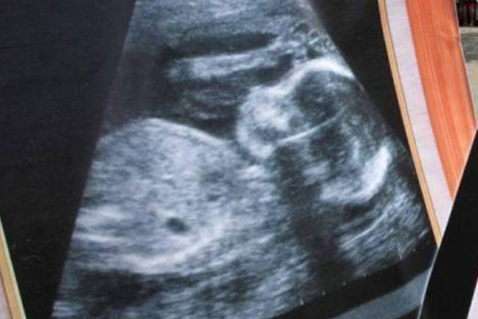 Mississippi surpreende e rejeita dar direitos de pessoa a um embrião