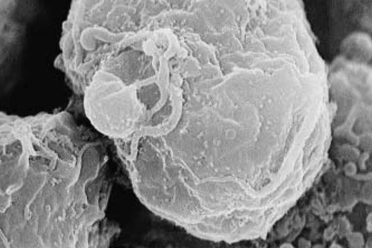 
	Descoberta: cientistas desenvolveram um modelo que permitir&aacute; estudar a infec&ccedil;&atilde;o pelo GBVC e desvendar qual &eacute; a estrat&eacute;gia do v&iacute;rus para impedir o desenvolvimento da aids
 (Wikimedia Commons)