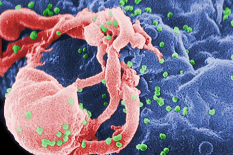 HIV: a vacina se baseia em um "calcanhar de Aquiles" do vírus, isto é, um local vulnerável de sua estrutura (C. Goldsmith / US CDC/Reprodução)