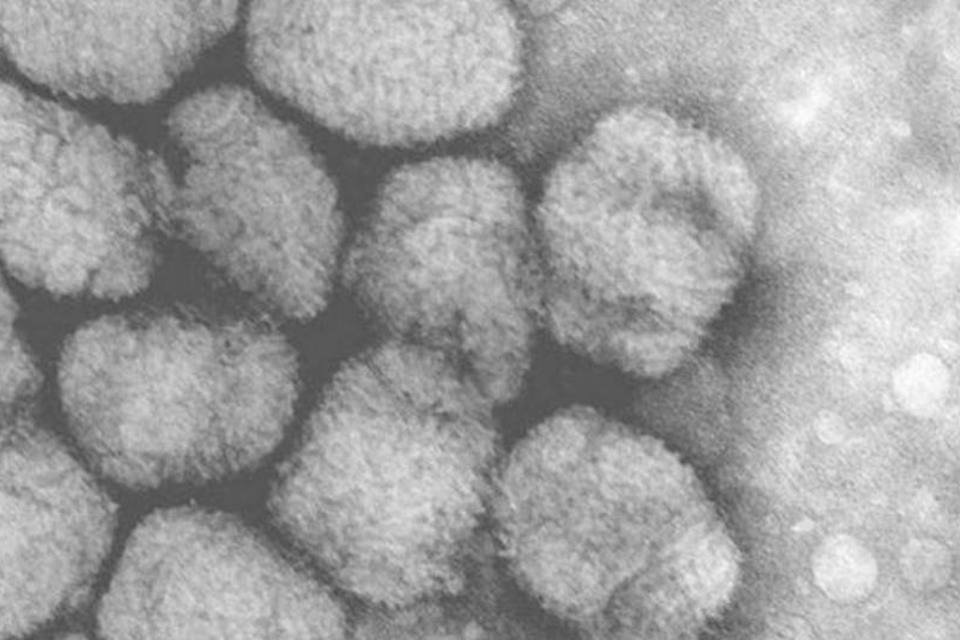 Segundo os pesquisadores, estima-se que o vírus monkeypox meça 300 nanômetros (AFP/Reprodução)