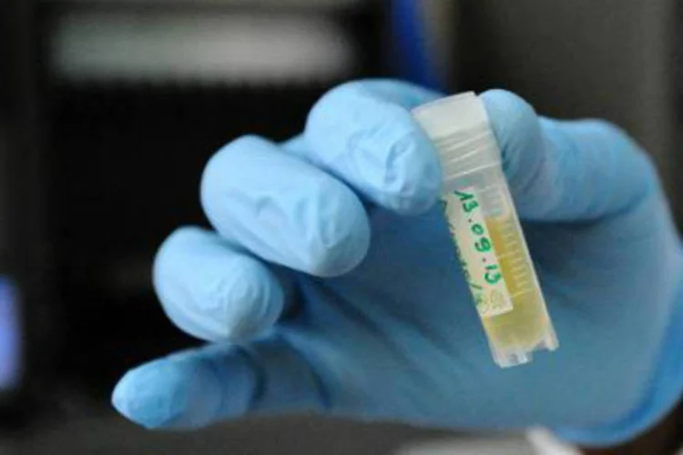 
	Amostra de pessoa que vive com HIV em laborat&oacute;rio: protocolo ficar&aacute; em consulta p&uacute;blica at&eacute; 9 de mar&ccedil;o
 (AFP)